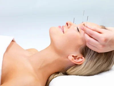 acupuncture_400